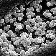 Малассезия