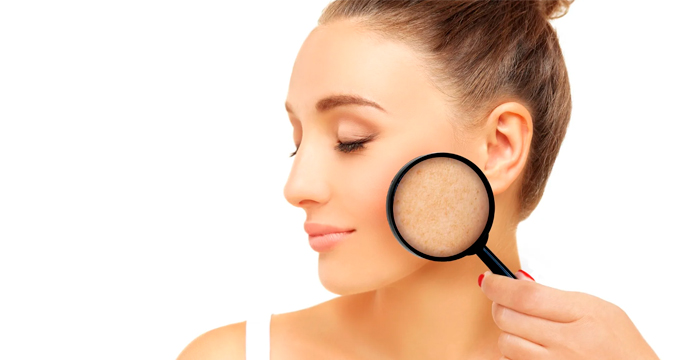 Подборка: Натуральная косметика от пигментных пятен