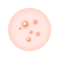 Проверка на комедогенность