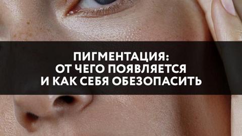 Отзыв: Пигментация: от чего появляется, как себя обезопасить