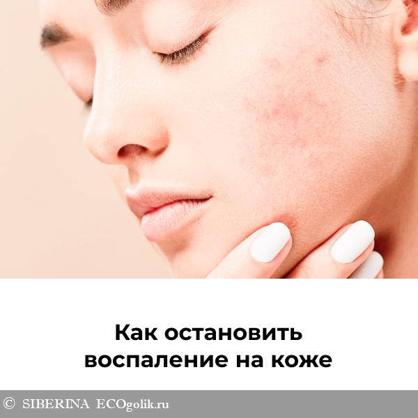 Как остановить воспаление на коже