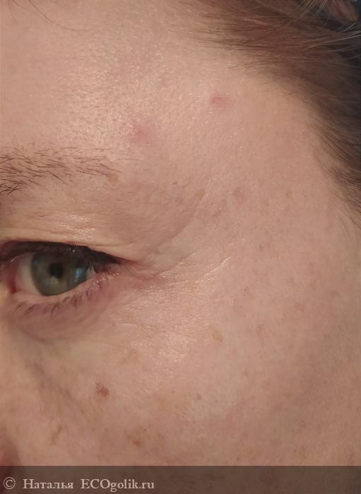 Мой опыт восстановления кожи лица и последующий ежедневный уход - отзыв Экоблогера Наталья