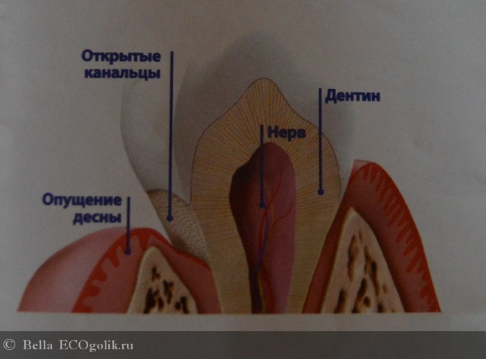 Дентинные канальцы зуба фото