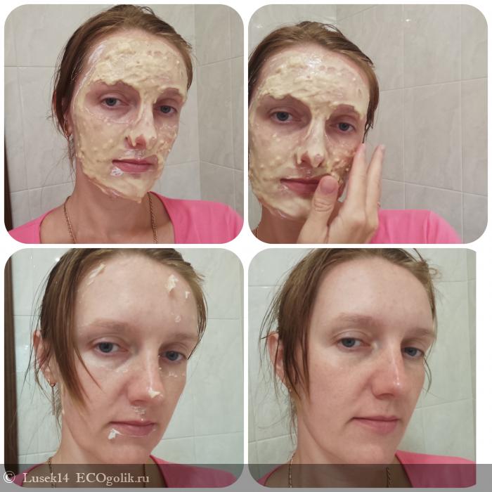   Anti-acne -   Lusek14