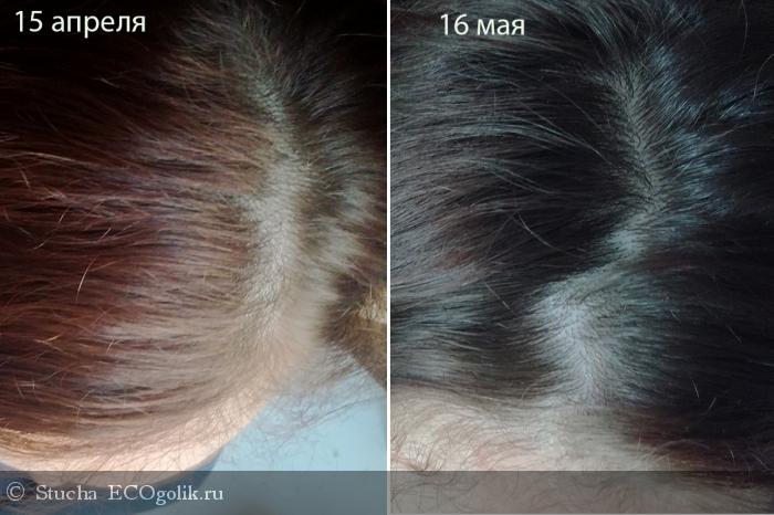 Крапива для волос: польза, борьба с выпадением, укрепление и стимуляция роста